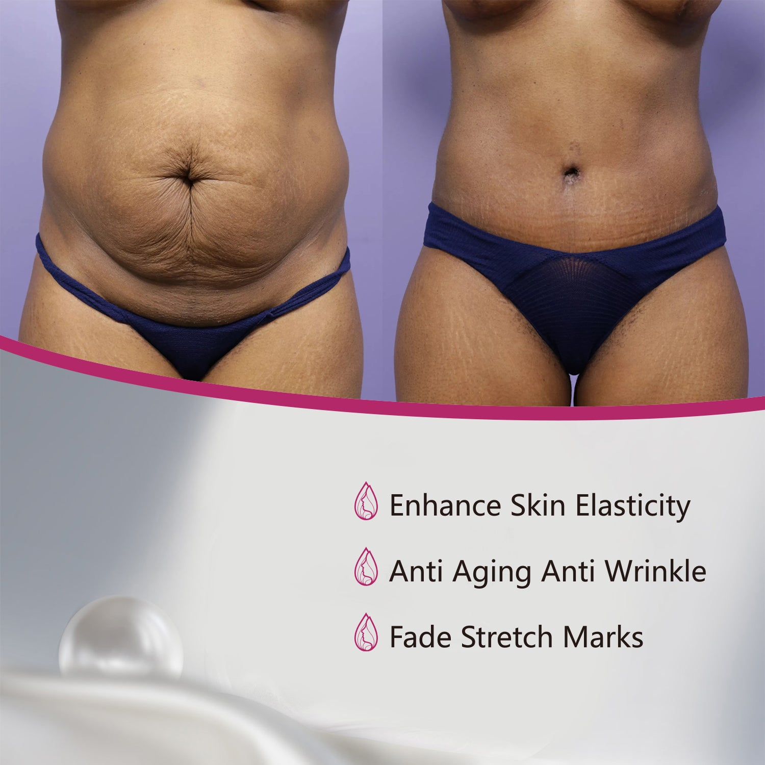 BIYODE Stretch Mark Oil